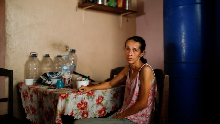 A skinny and malnourished woman poses for a picture while sitting at a table at her home in Caracas, Venezuela. 