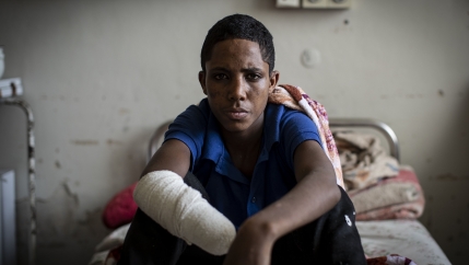 A boy wearing blue sits on hospital bed with wrapped bandage from missing limbs.