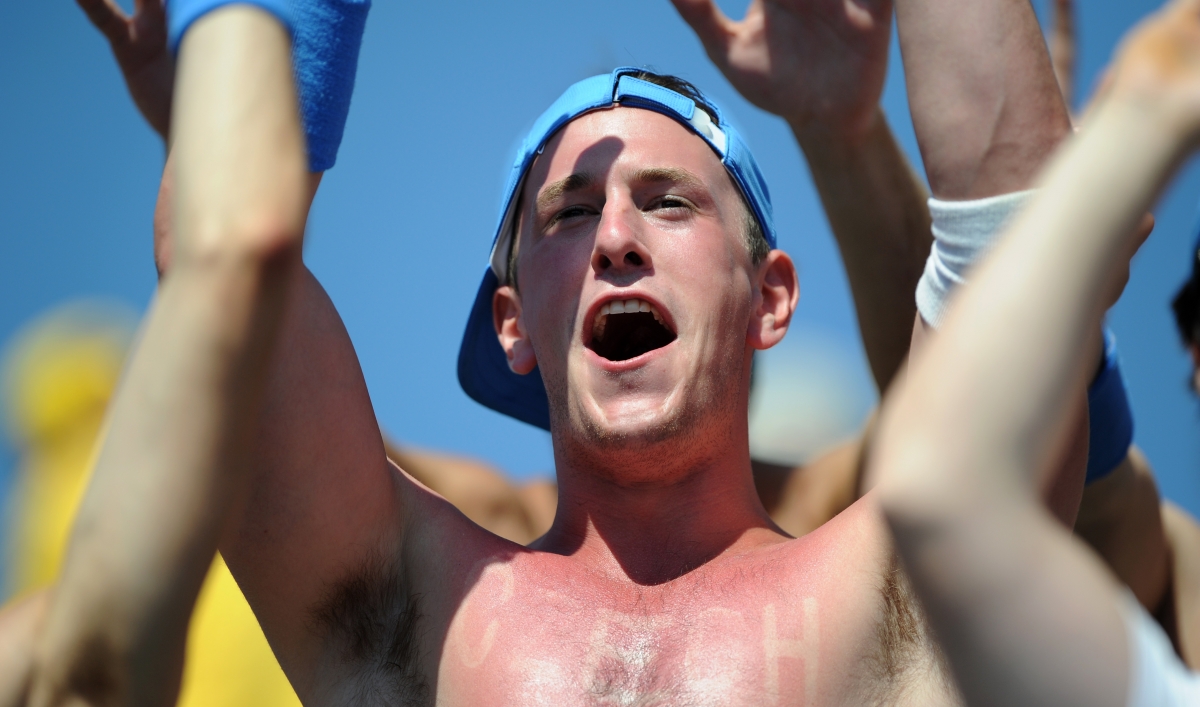 Sunburn science what causes them to hurt? The World from PRX