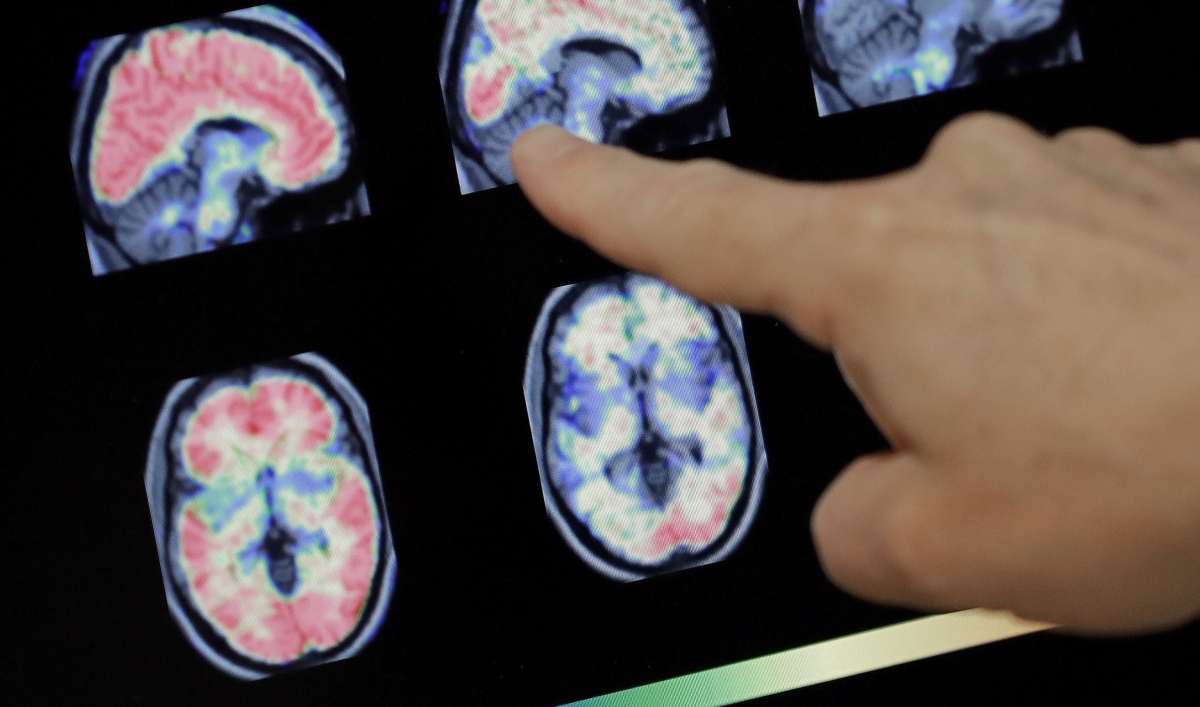 You can retrain your brain to think differently, says neuroscientist - Vimarsana News