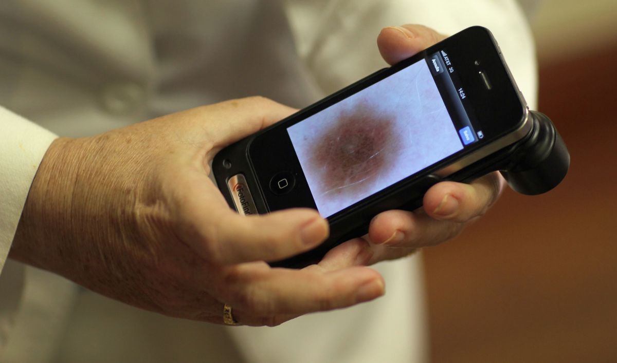 Melanoma early detection device wins FDA approval The World from PRX
