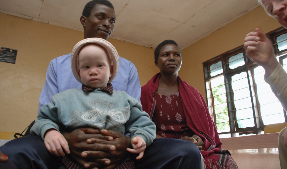 The ritual murders of albinos in parts of Africa: 6 things you need to know about the cultural beliefs