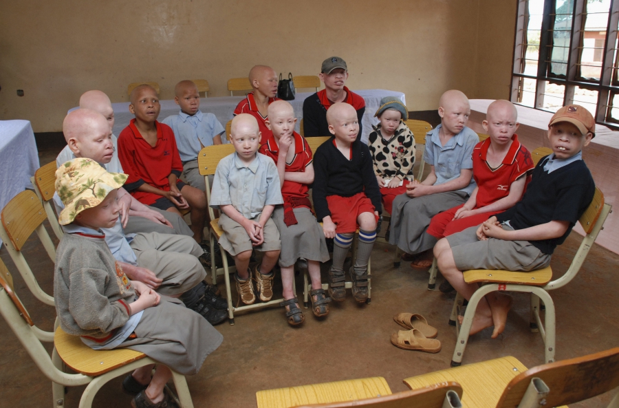 Children with albinism sit at the Golden Valley English Medium School, a school sponsored by Under the Same Sun (UTSS), in Geita November 24, 2011. Children with albinism sit at the Golden Valley English Medium School, a school sponsored by Under the Same Sun (UTSS), in Geita November 24, 2011.