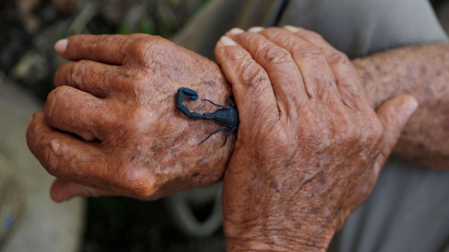 Farmer Pepe Casanas places the scorpion on his body where he feels the most pain. The sting hurts, but the relief from rheumatism is worth it. Casanas lives in Los Palacios, Cuba, Dec. 5, 2018. Two hands with a scorpion.