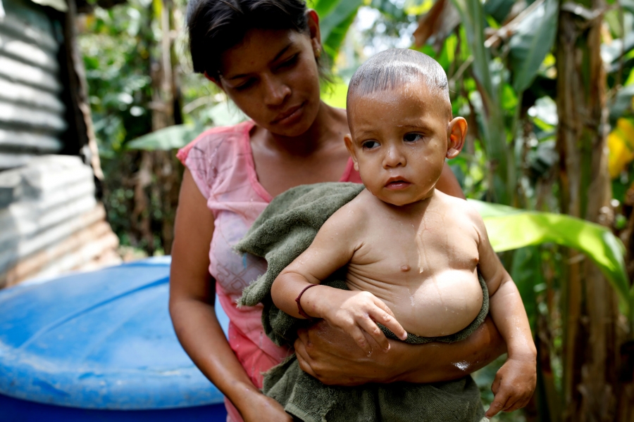 Maria Guitia carries her son Yeibe Medina after bathing him at home. Maria Guitia is shown carrying her son Yeibe Medina, still wet from a bath.