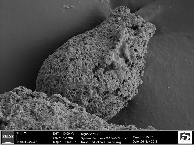 A microscopic image