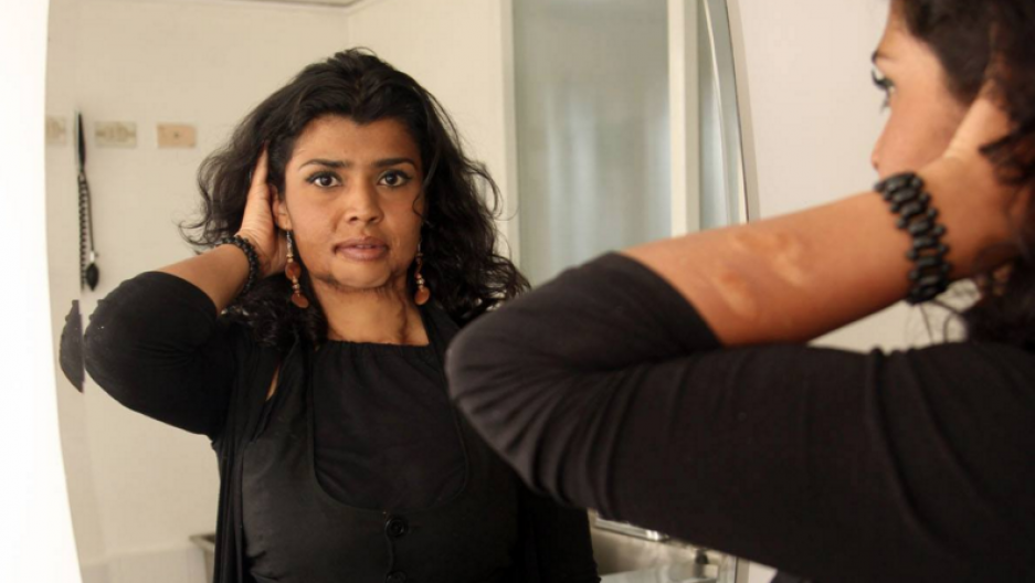 Colombia finally cracks down on a horrific wave of acid attacks against