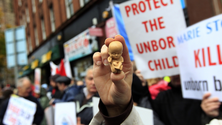 pro life abortion is illegal This is what happens when abortion is outlawed abortion is illegal (or only permitted to save the mother’s life). pro life abortion is illegal This is what happens when abortion is outlawed abortion is illegal (or only permitted to save the mother’s life).