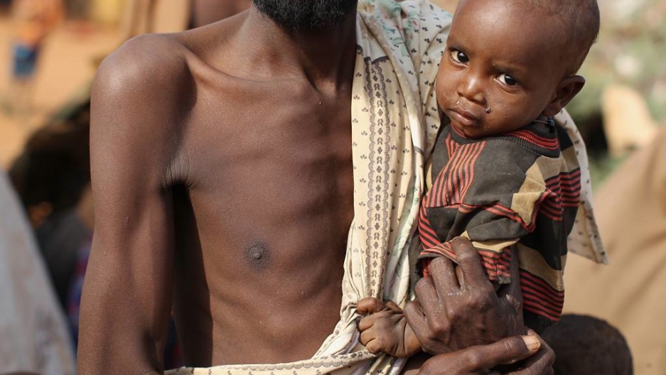 U N Calls For Crisis Talks Over African Famine The World From Prx U N Calls For Crisis Talks Over African Famine The World From Prx