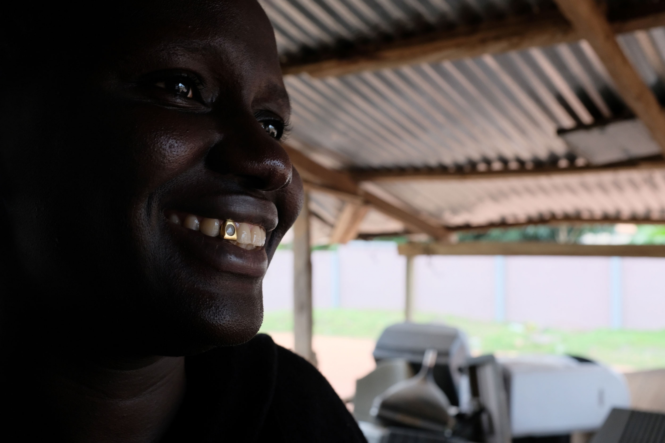 Asante shows her gold tooth. A woman is show in a close-up photo smiling with a gold tooth that has a circle shape in the middle.