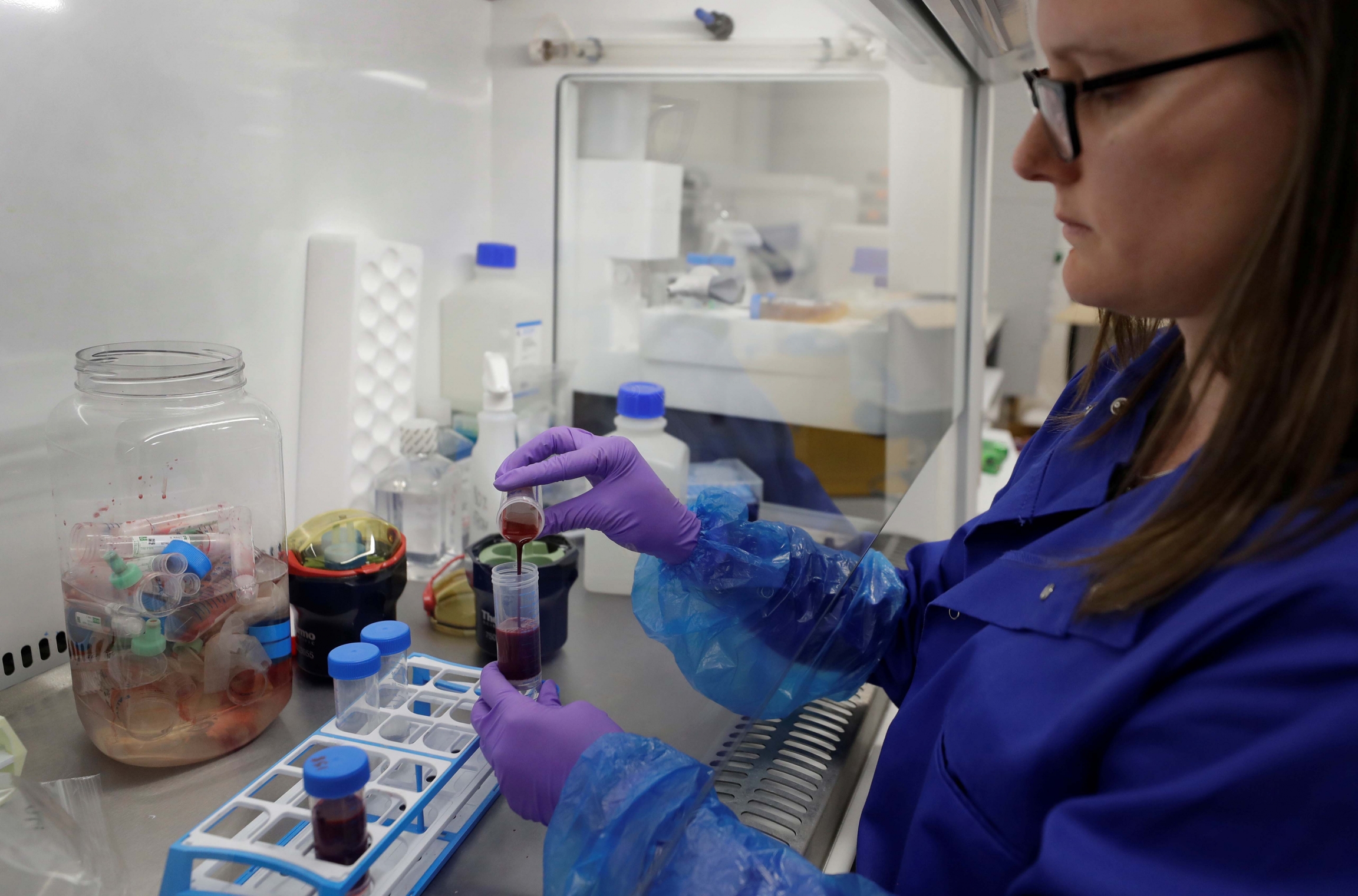 A PhD research associate prepares blood samples from patients infected with the coronavirus disease (COVID-19) for analysis at the Cambridge Institute of Therapeutic Immunology and Infectious Disease, in Cambridge, Britain, on May 21, 2020. A PhD research associate prepares blood samples from patients infected with the coronavirus disease (COVID-19) for analysis at the Cambridge Institute of Therapeutic Immunology and Infectious Disease, in Cambridge, Britain, on May 21, 2020.