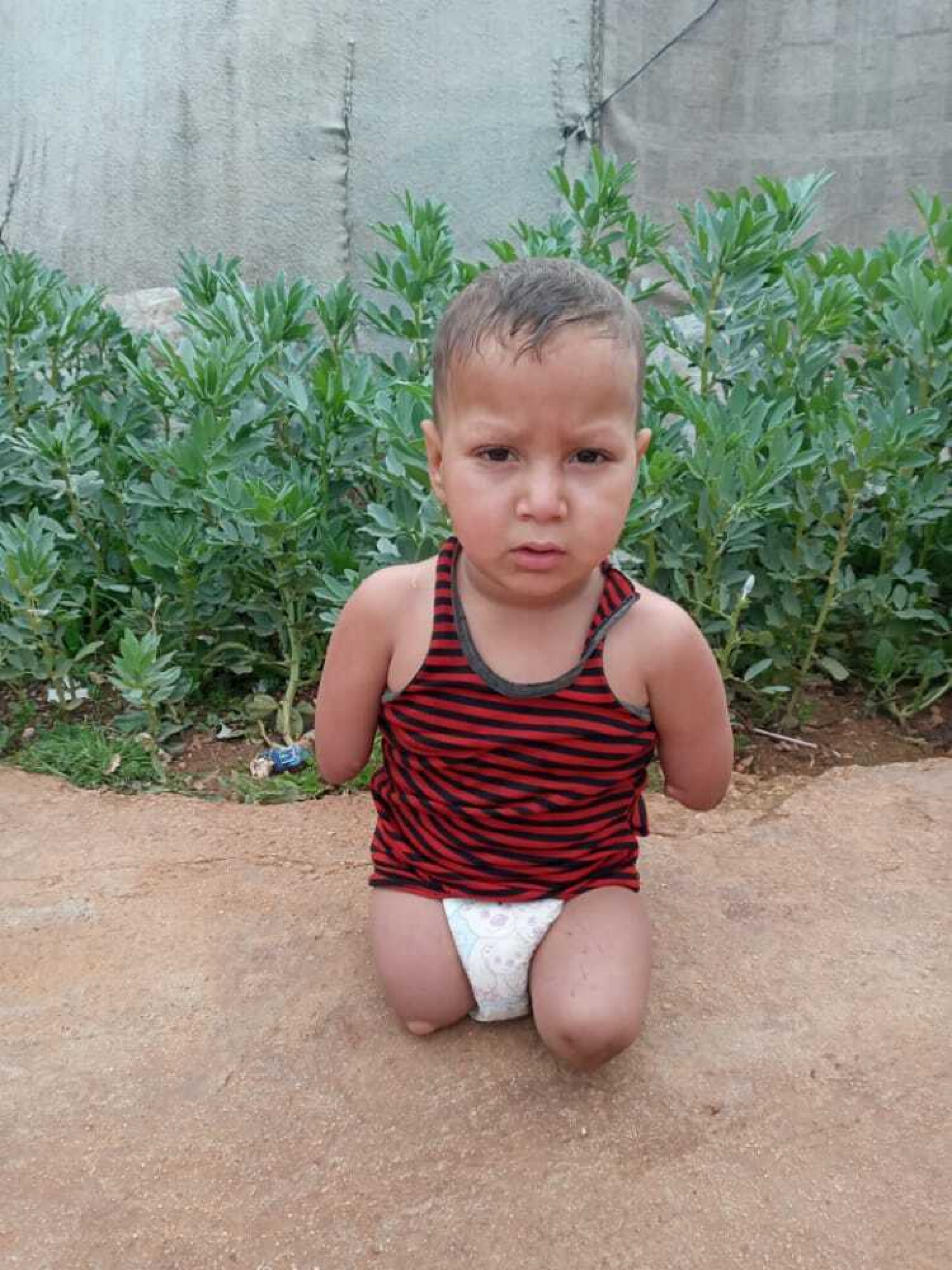 Four-year-old Assef al-Ablo, whose parents lived in the Khan Sheikhoun area in Syria, where the 2017 chemical attack took place, was born without limbs. Four-year-old Assef al-Ablo, whose parents lived in the Khan Sheikhoun area in Syria, where the 2017 chemical attack took place, was born without limbs.