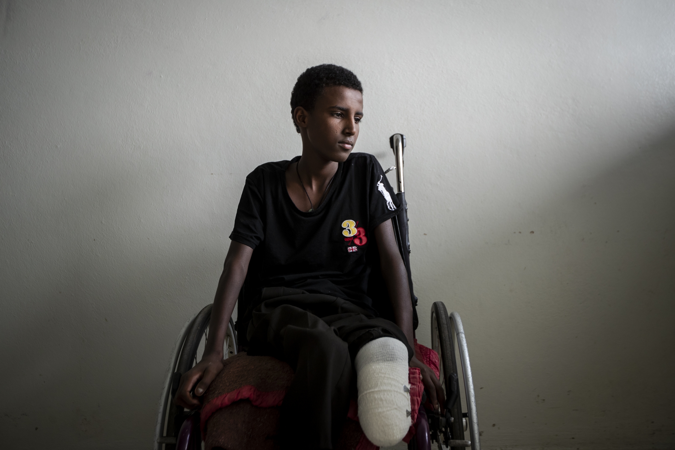 Mikiele Kahsay, 16, sits in a wheelchair at the Ayder Referral Hospital in Mekele, in the Tigray region of northern Ethiopia, on Thursday, May 6, 2021. Boy in wheelchair