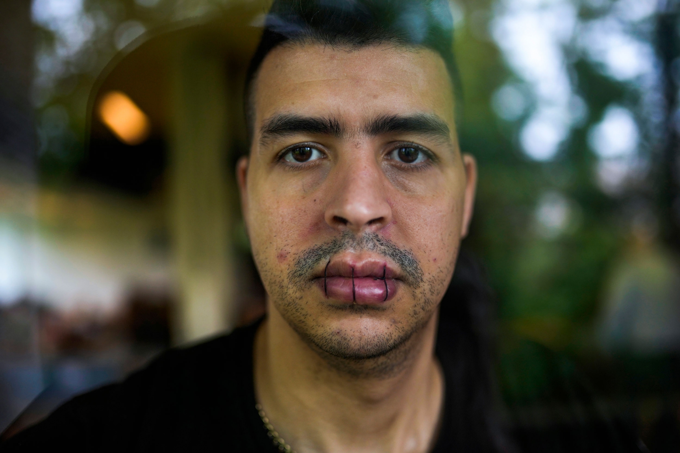 A man from Morocco, no name given, with his lips sewn together and on hunger strike poses for a photo as he occupies with others a big room of the ULB Francophone university in Brussels, June 29, 2021. A close up portrait of a man who has sewn his lips together with three stitches.