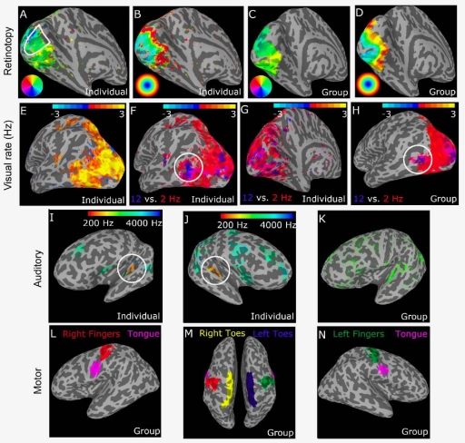 brain images
