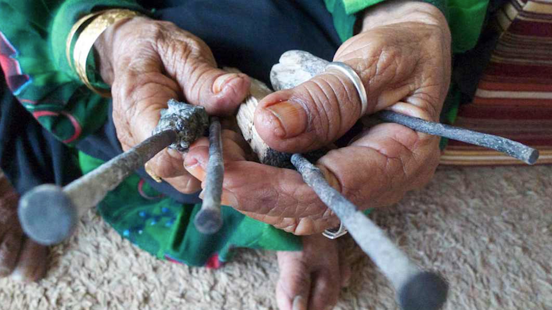 Staying healthy on the Out of Eden Walk